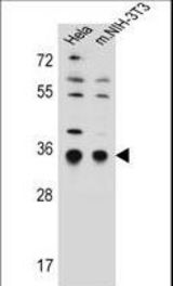 SSR1 Antibody western blot of HeLa,mouse NIH-3T3 cell line lysates (35 ug/lane). The SSR1 antibody detected the SSR1 protein (arrow).
