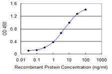 Detection limit for recombinant GST tagged SSTR1 is 0.03 ng/ml as a capture antibody.