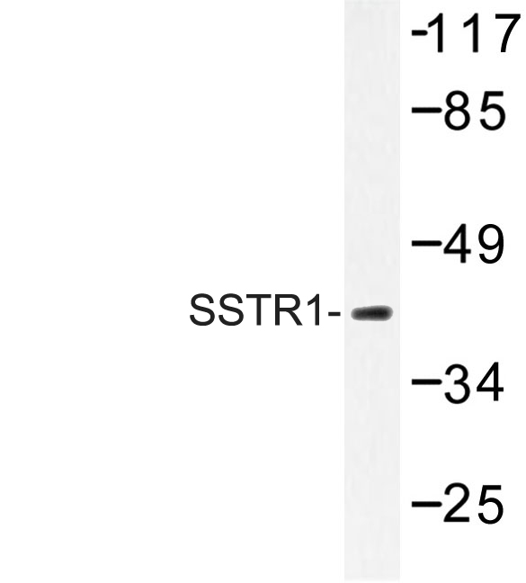 Western blot of SSTR1 (N48) pAb in extracts from COS-7 cells.