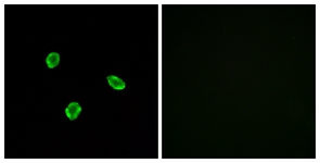 Immunofluorescence of A549 cells, using SSTR1 Antibody. The picture on the right is treated with the synthesized peptide.