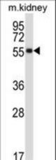 SSTR1 Antibody western blot of mouse kidney tissue lysates (35 ug/lane). The SSTR1 antibody detected the SSTR1 protein (arrow).