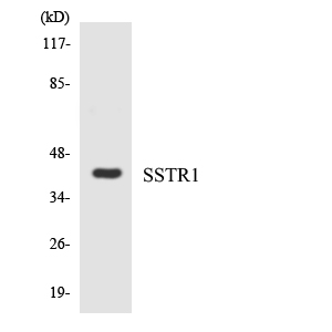 Western blot of the lysates from COLO205 cells using SSTR1 antibody.