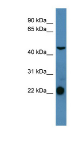 SSTR1 antibody LS-B6954 Western blot of THP-1 cell lysate.