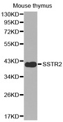 Western blot analysis of extracts of mouse thymus tissue lysate, using SSTR2 antibody.