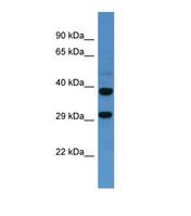 Western blot of Human Fetal Brain. SSTR2 antibody dilution 1.0 ug/ml.