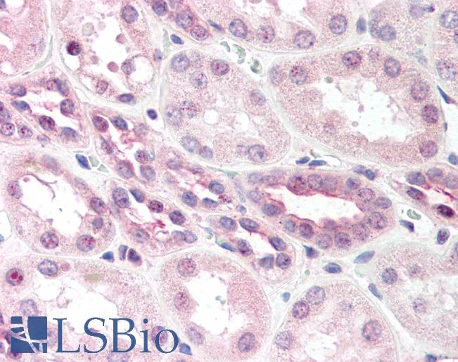 Anti-SSTR2 antibody IHC of human kidney. Immunohistochemistry of formalin-fixed, paraffin-embedded tissue after heat-induced antigen retrieval. Antibody LS-B312 dilution 1:500.