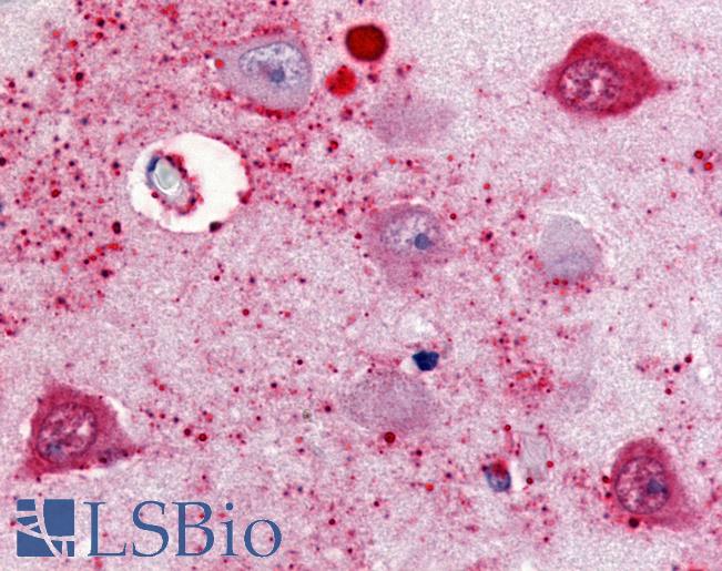 Anti-SSTR2 antibody LS-A999 IHC of human brain, subiculum neurons. Immunohistochemistry of formalin-fixed, paraffin-embedded tissue after heat-induced antigen retrieval.