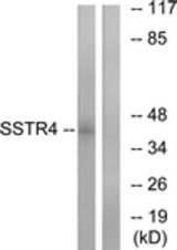 Western blot of extracts from LOVO cells, using SSTR4 Antibody. The lane on the right is treated with the synthesized peptide.