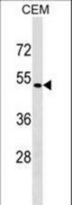 SSTR5 Antibody western blot of CEM cell line lysates (35 ug/lane). The SSTR5 antibody detected the SSTR5 protein (arrow).
