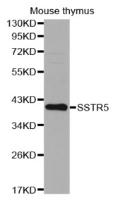 Western blot analysis of extracts of Mouse thymus, using SSTR5 antibody.
