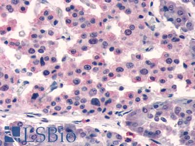 Anti-SSTR5 antibody LS-A2639 IHC of human pancreas. Immunohistochemistry of formalin-fixed, paraffin-embedded tissue after heat-induced antigen retrieval.