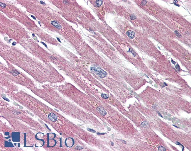 Anti-SSTR5 antibody LS-A2637 IHC of human heart. Immunohistochemistry of formalin-fixed, paraffin-embedded tissue after heat-induced antigen retrieval.