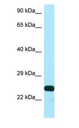 SSU72 antibody Western Blot of Placenta.