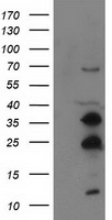HEK293T cells were transfected with the pCMV6-ENTRY control (Left lane) or pCMV6-ENTRY SSX1 (Right lane) cDNA for 48 hrs and lysed. Equivalent amounts of cell lysates (5 ug per lane) were separated by SDS-PAGE and immunoblotted with anti-SSX1.