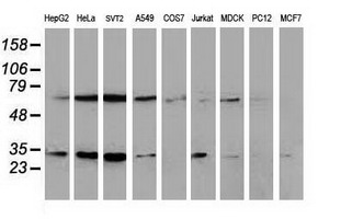 Western blot of extracts (35 ug) from 9 different cell lines by using anti-SSX1 monoclonal antibody.