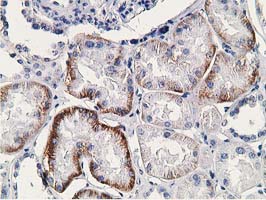 IHC of paraffin-embedded Human Kidney tissue using anti-SSX1 mouse monoclonal antibody.