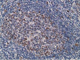 IHC of paraffin-embedded Human lymph node tissue using anti-SSX1 mouse monoclonal antibody.