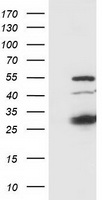HEK293T cells were transfected with the pCMV6-ENTRY control (Left lane) or pCMV6-ENTRY SSX1 (Right lane) cDNA for 48 hrs and lysed. Equivalent amounts of cell lysates (5 ug per lane) were separated by SDS-PAGE and immunoblotted with anti-SSX1.