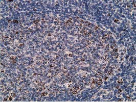 IHC of paraffin-embedded Human lymph node tissue using anti-SSX1 mouse monoclonal antibody. (Heat-induced epitope retrieval by 10mM citric buffer, pH6.0, 100C for 10min).