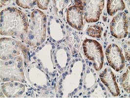 IHC of paraffin-embedded Human Kidney tissue using anti-SSX1 mouse monoclonal antibody. (Heat-induced epitope retrieval by 10mM citric buffer, pH6.0, 100C for 10min).