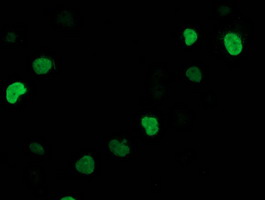 Anti-SSX1 mouse monoclonal antibody immunofluorescent staining of COS7 cells transiently transfected by pCMV6-ENTRY SSX1.