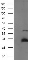 HEK293T cells were transfected with the pCMV6-ENTRY control (Left lane) or pCMV6-ENTRY SSX1 (Right lane) cDNA for 48 hrs and lysed. Equivalent amounts of cell lysates (5 ug per lane) were separated by SDS-PAGE and immunoblotted with anti-SSX1.