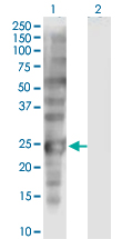 Western Blot analysis of SSX1 expression in transfected 293T cell line by SSX1 monoclonal antibody (M01), clone 5B2.Lane 1: SSX1 transfected lysate (Predicted MW: 21.9 KDa).Lane 2: Non-transfected lysate.