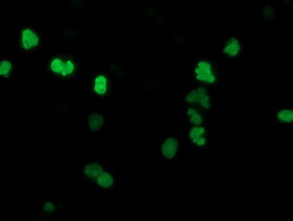 Anti-SSX1 mouse monoclonal antibody immunofluorescent staining of COS7 cells transiently transfected by pCMV6-ENTRY SSX1.