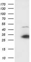HEK293T cells were transfected with the pCMV6-ENTRY control (Left lane) or pCMV6-ENTRY SSX1 (Right lane) cDNA for 48 hrs and lysed. Equivalent amounts of cell lysates (5 ug per lane) were separated by SDS-PAGE and immunoblotted with anti-SSX1.