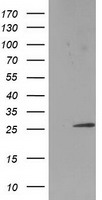 HEK293T cells were transfected with the pCMV6-ENTRY control (Left lane) or pCMV6-ENTRY SSX1 (Right lane) cDNA for 48 hrs and lysed. Equivalent amounts of cell lysates (5 ug per lane) were separated by SDS-PAGE and immunoblotted with anti-SSX1.