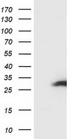HEK293T cells were transfected with the pCMV6-ENTRY control (Left lane) or pCMV6-ENTRY SSX1 (Right lane) cDNA for 48 hrs and lysed. Equivalent amounts of cell lysates (5 ug per lane) were separated by SDS-PAGE and immunoblotted with anti-SSX1.