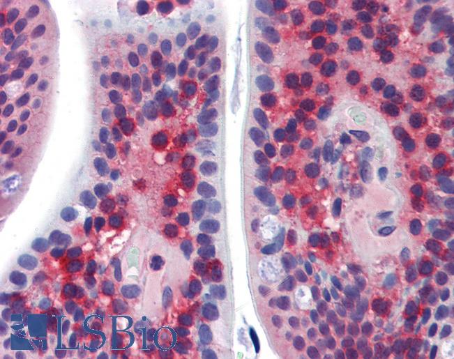 Anti-SSX2IP antibody IHC of human small intestine. Immunohistochemistry of formalin-fixed, paraffin-embedded tissue after heat-induced antigen retrieval. Antibody LS-B3569 concentration 5 ug/ml.