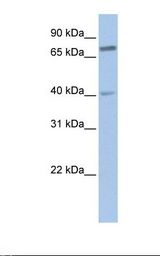 721_B cell lysate. Antibody concentration: 1.0 ug/ml. Gel concentration: 12%.