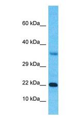 Western blot of SSX3 Antibody with human Fetal Kidney lysate.