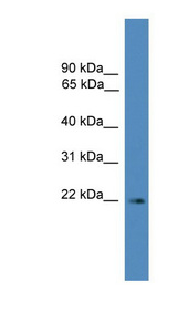 SSX3 antibody LS-C116805 Western blot of Jurkat lysate.