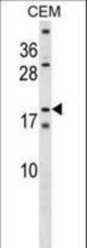SSX4 Antibody western blot of CEM cell line lysates (35 ug/lane). The SSX4 antibody detected the SSX4 protein (arrow).
