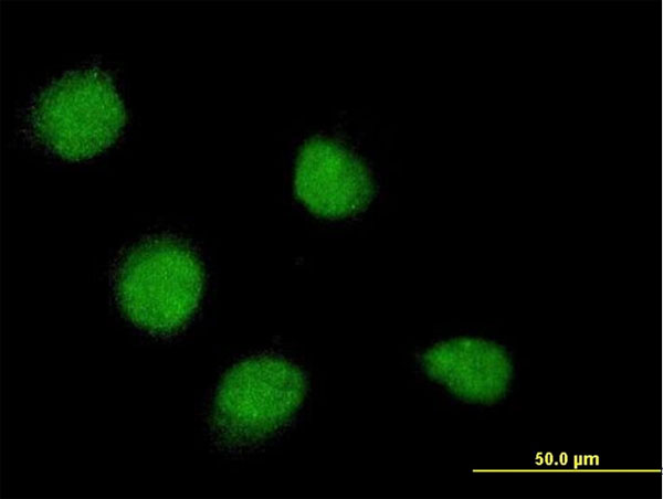 Immunofluorescence of monoclonal antibody to SSX4 on HeLa cell . [antibody concentration 10 ug/ml]