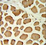 Formalin-fixed and paraffin-embedded human skeletal muscle reacted with PTPN11 Antibody , which was peroxidase-conjugated to the secondary antibody, followed by DAB staining. This data demonstrates the use of this antibody for immunohistochemistry; clinical relevance has not been evaluated.