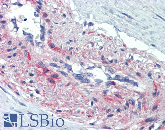 Anti-SSX4 antibody IHC of human vessel, smooth muscle. Immunohistochemistry of formalin-fixed, paraffin-embedded tissue after heat-induced antigen retrieval. Antibody LS-B3514 concentration 5 ug/ml.
