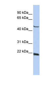SSX4 antibody LS-B3514 Western blot of HepG2 cell lysate.