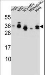 SSX4 Antibody western blot of CEM,K562,NCI-H292,MDA-MB453,A549 cell line lysates (35 ug/lane). The SSX4 antibody detected the SSX4 protein (arrow).