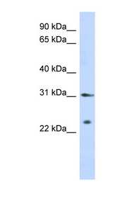 SSX5 antibody LS-C110103 Western blot of Transfected 293T cell lysate.