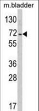 Western blot of PTPN11 Antibody in mouse bladder tissue lysates (35 ug/lane). PTPN11 (arrow) was detected using the purified antibody.