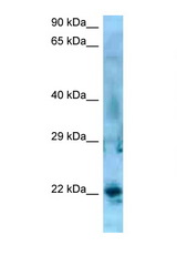 SSX5 antibody LS-C146508 Western blot of Jurkat Cell lysate. Antibody concentration 1 ug/ml.