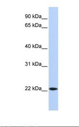 721_B cell lysate. Antibody concentration: 1.0 ug/ml. Gel concentration: 12%.
