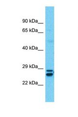 Western blot of Human Thymus Tumor. SSX5 antibody dilution 1.0 ug/ml.