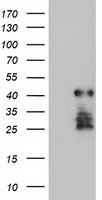 HEK293T cells were transfected with the pCMV6-ENTRY control (Left lane) or pCMV6-ENTRY SSX5 (Right lane) cDNA for 48 hrs and lysed. Equivalent amounts of cell lysates (5 ug per lane) were separated by SDS-PAGE and immunoblotted with anti-SSX5.