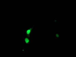 Anti-SSX5 mouse monoclonal antibody immunofluorescent staining of COS7 cells transiently transfected by pCMV6-ENTRY SSX5.