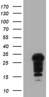HEK293T cells were transfected with the pCMV6-ENTRY control (Left lane) or pCMV6-ENTRY SSX5 (Right lane) cDNA for 48 hrs and lysed. Equivalent amounts of cell lysates (5 ug per lane) were separated by SDS-PAGE and immunoblotted with anti-SSX5.