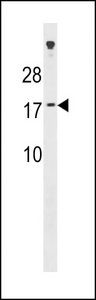 SSX7 Antibody western blot of A549 cell line lysates (35 ug/lane). The SSX7 antibody detected the SSX7 protein (arrow).
